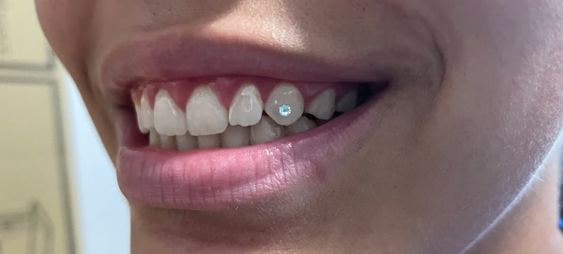 DIY Tooth Gem Jewelry Crystal Diamond Teeth Decoration w/ Curing